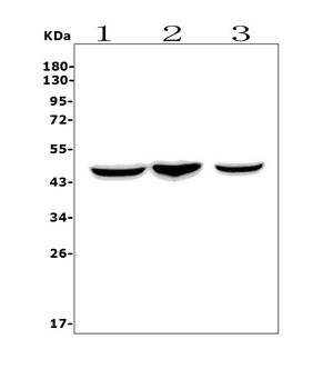 Anti-CCR2 Antibody