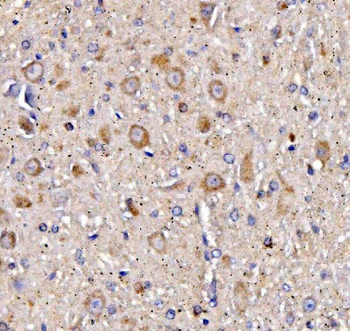 Anti-Muscarinic Acetylcholine Receptor 1/CHRM1 Antibody