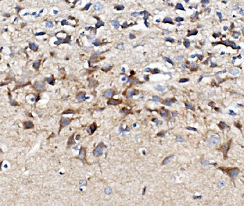 Anti-Muscarinic Acetylcholine Receptor 1/CHRM1 Antibody