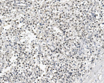 Anti-DAZL Antibody