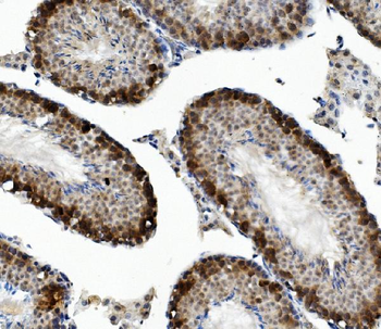 Anti-DAZL Antibody