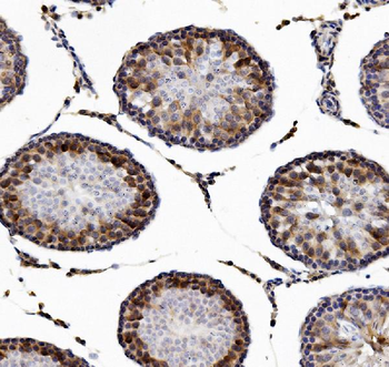 Anti-DAZL Antibody