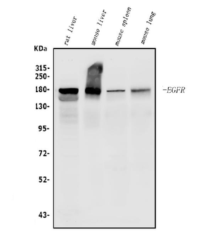 Anti-EGFR Antibody