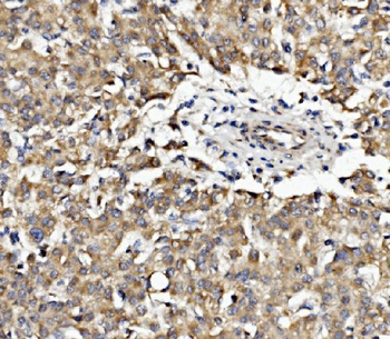 Anti-Band 4.1-like protein 5 EPB41L5 Antibody