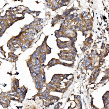 Anti-Band 4.1-like protein 5 EPB41L5 Antibody