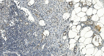 Anti-FLCN Antibody