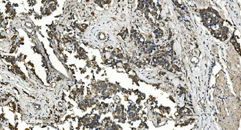 Anti-FLCN Antibody