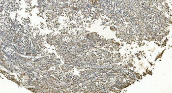 Anti-FLCN Antibody
