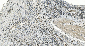Anti-FLCN Antibody