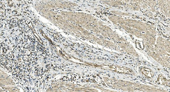 Anti-FLCN Antibody