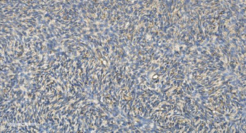 Anti-FLCN Antibody