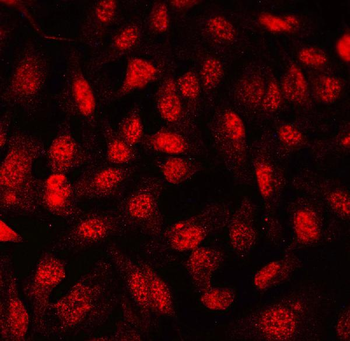 Anti-FLI1 Antibody