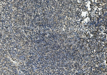 Anti-FLI1 Antibody
