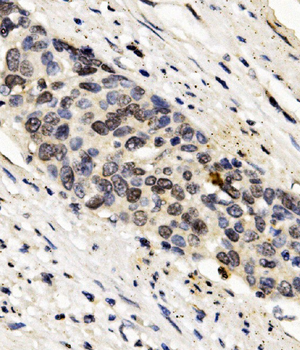 Anti-FOXF1 Antibody