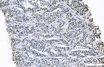 Anti-FOXK1/MNF Antibody