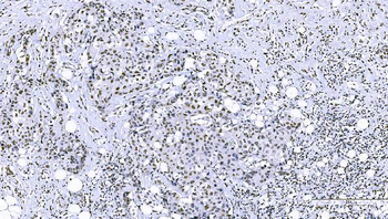 Anti-FOXK1/MNF Antibody