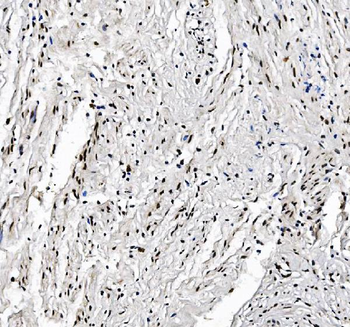 Anti-FOXK1/MNF Antibody