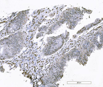 Anti-FOXK1/MNF Antibody