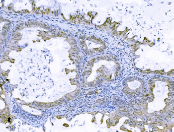 Anti-FOXK1/MNF Antibody