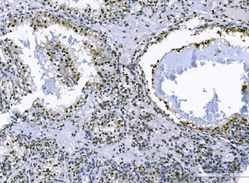 Anti-FOXK1/MNF Antibody