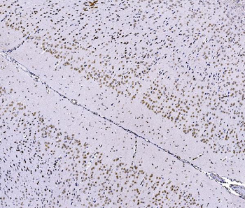 Anti-FOXK1/MNF Antibody