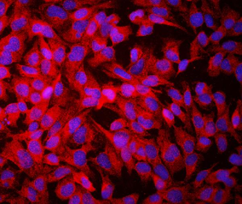 Anti-Growth hormone receptor/GHR Antibody