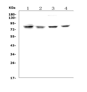 Anti-Growth hormone receptor/GHR Antibody