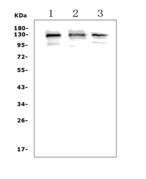 Anti-Growth hormone receptor/GHR Antibody