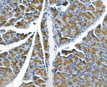 Anti-GP2 Antibody