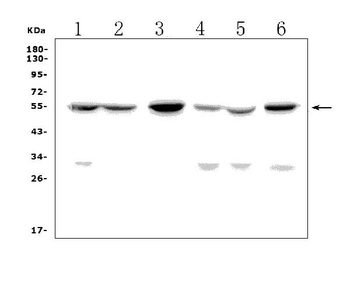 Anti-GP2 Antibody