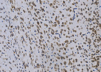 Anti-GPNMB/Gpnmb Antibody