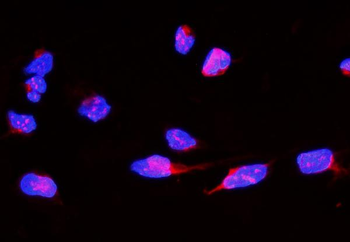 Anti-CD168/HMMR Antibody