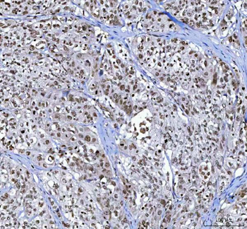Anti-Menin/MEN1 Antibody