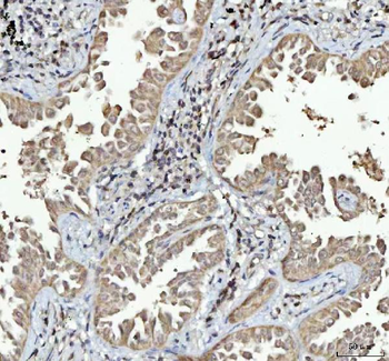 Anti-Menin/MEN1 Antibody