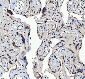 Anti-Menin/MEN1 Antibody
