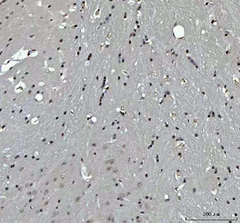 Anti-Menin/MEN1 Antibody