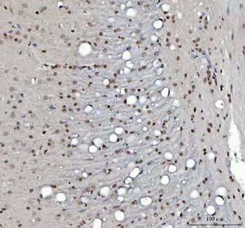 Anti-Menin/MEN1 Antibody