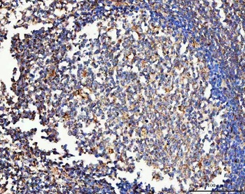Mannose Receptor/MRC1 Antibody