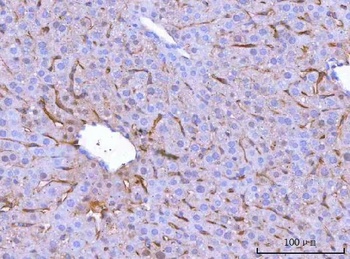 Mannose Receptor/MRC1 Antibody