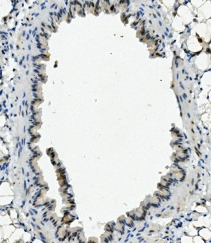 XLF/NHEJ1 Antibody