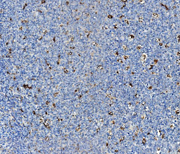 Anti-Niemann Pick C2/NPC2 Antibody