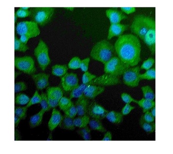 Niemann Pick C2/NPC2 Antibody