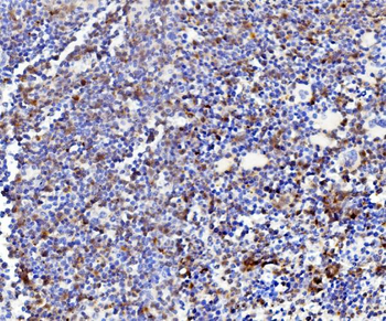 Anti-Niemann Pick C2/NPC2 Antibody