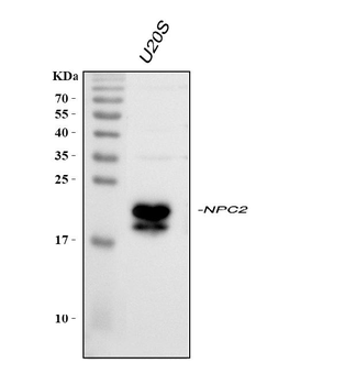 Anti-Niemann Pick C2/NPC2 Antibody
