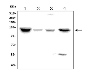 Anti-Natriuretic Peptide Receptor A/GC-A/NPR1 Antibody