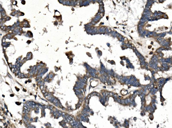 Anti-PICALM Antibody