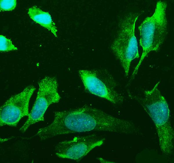 Anti-PLD2 Antibody