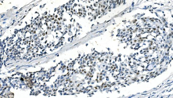 Anti-PPM1A Antibody