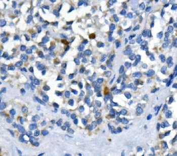 Anti-PPM1A Antibody