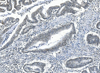 Anti-PPM1A Antibody